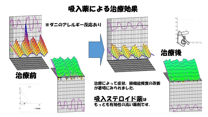 resp02-5